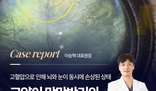 고양이 시력저하 원인, 망막박리와…